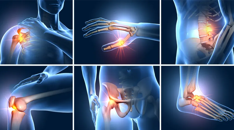 Defining Joint Pain